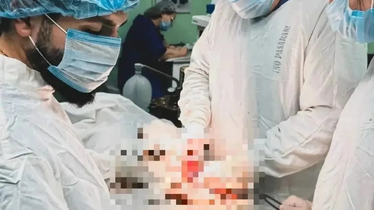 В ККБ №2 успешно прооперировали пациента с гигантской паховой грыжей — Краснодар Сейчас