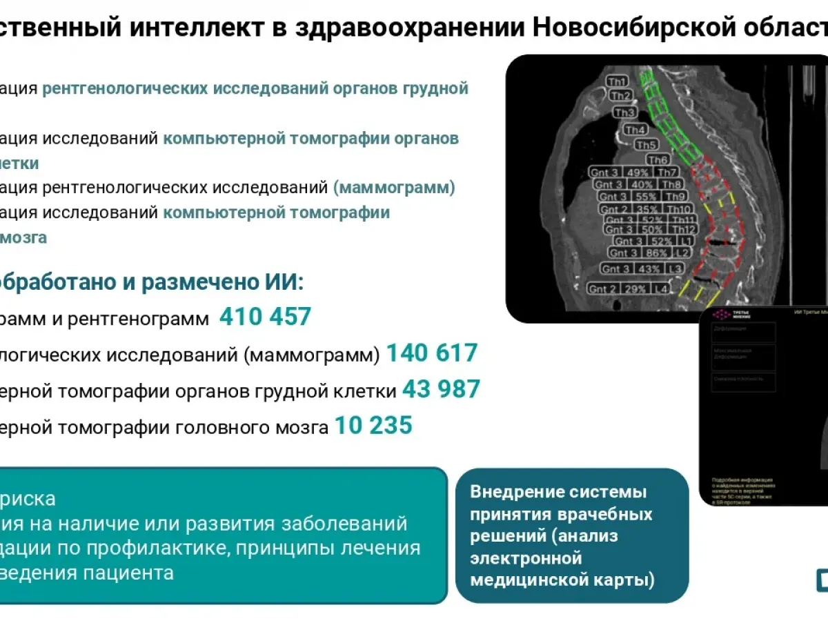 В Новосибирской области обсудили цифровую трансформацию здравоохранения