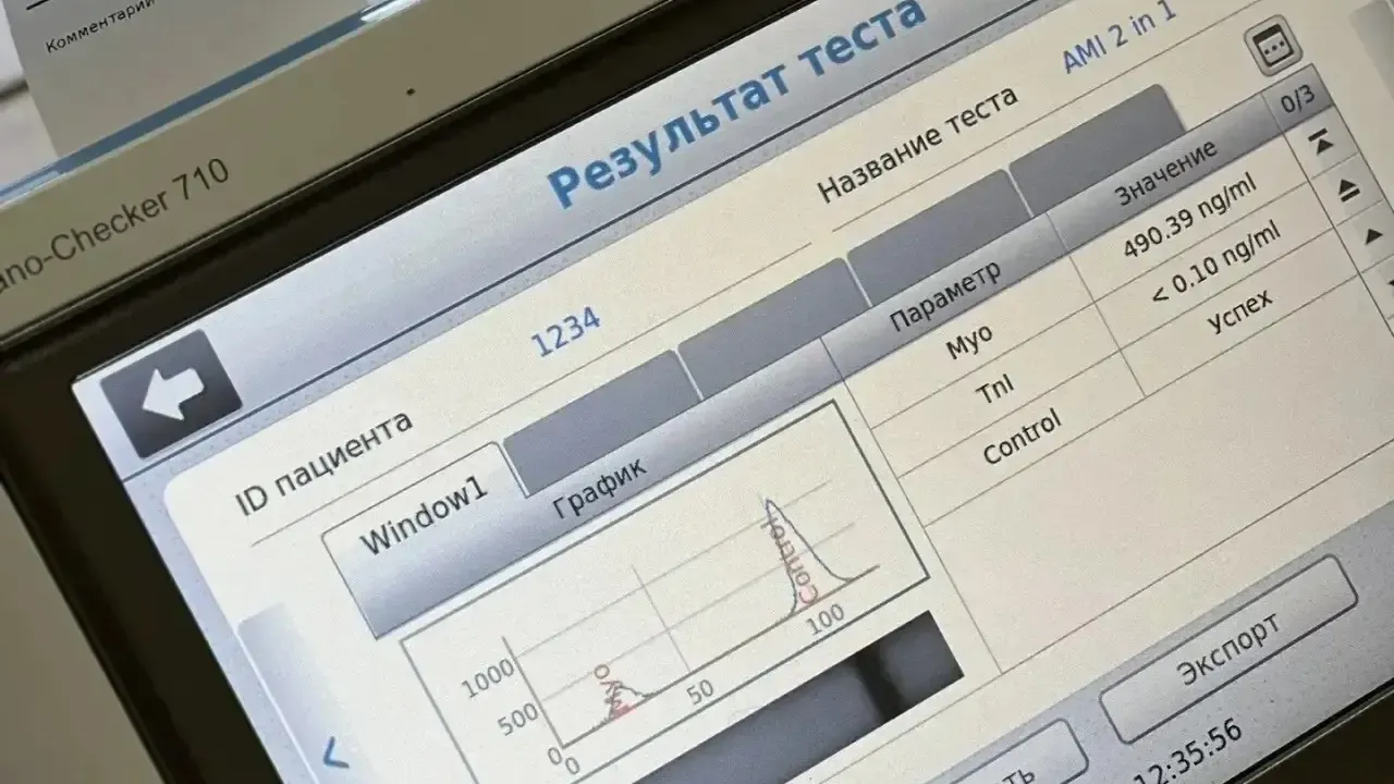В Красноармейской больнице используют экспресс-анализатор критических состояний — Саратов Сейчас